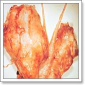 симптомы везикулита